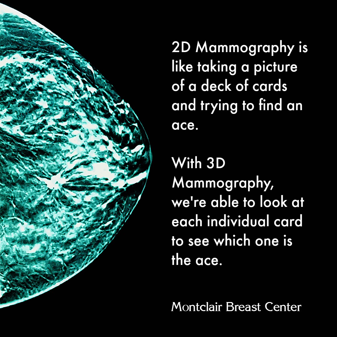 3d mammogram