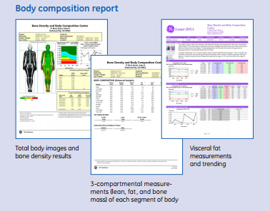 Bone composition report